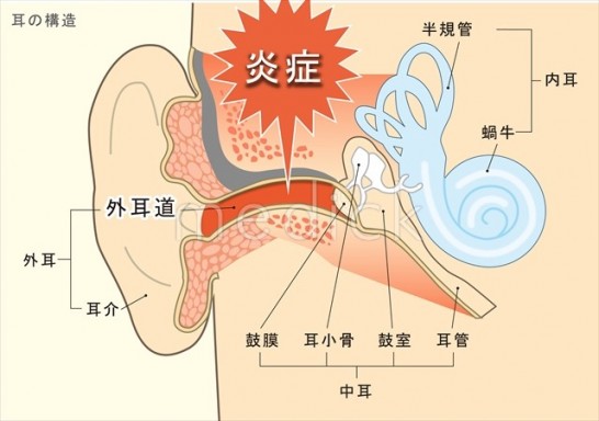 外耳炎 (1)